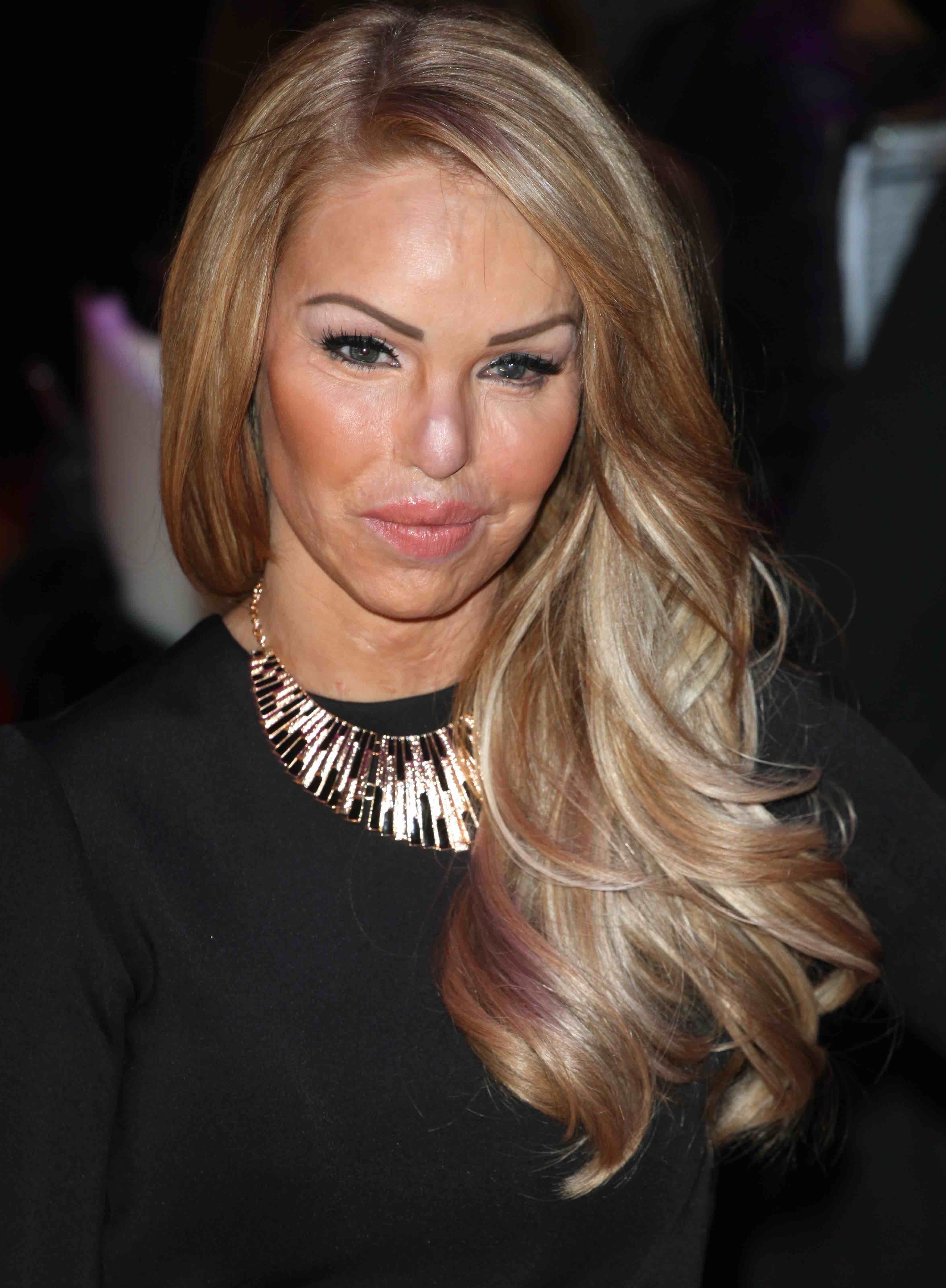 Katie Piper 